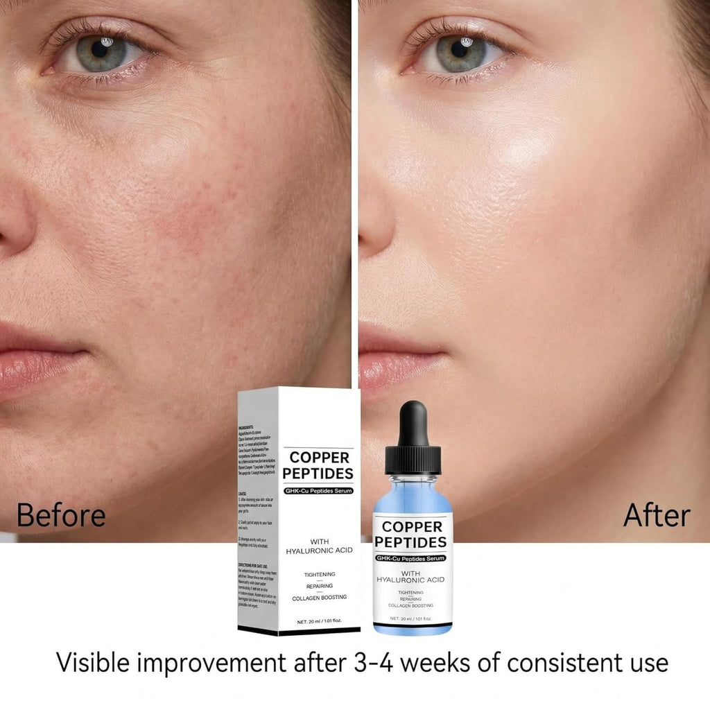 Copper Peptide Serum for Fine Lines & Wrinkles,Hydrating Skin Care 1 Fl Oz